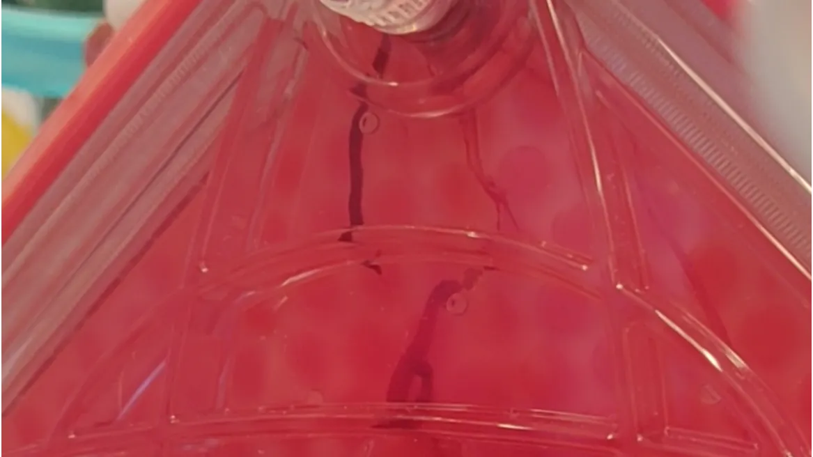 Clot formation in an ECMO oxygenator